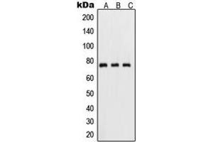 Western blot analysis of NF-kappaB p65 (pS311) expression in HeLa TNFa-treated (A), mouse kidney (B), PC12 UV-treated (C) whole cell lysates. (NF-kB p65 Antikörper  (pSer311))
