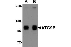 Western Blotting (WB) image for anti-Autophagy Related 9B (ATG9B) (C-Term) antibody (ABIN1030265) (ATG9B Antikörper  (C-Term))