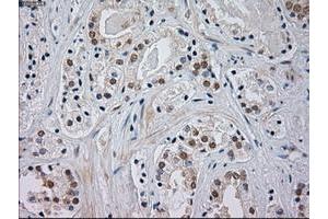 Immunohistochemistry (IHC) image for anti-Mitogen-Activated Protein Kinase 8 (MAPK8) (AA 1-384) antibody (ABIN1490768) (JNK Antikörper  (AA 1-384))