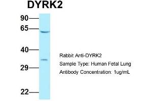 Host: Rabbit  Target Name: DYRK2  Sample Tissue: Human Fetal Lung  Antibody Dilution: 1. (DYRK2 Antikörper  (C-Term))