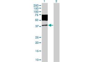 Western Blot analysis of MICA expression in transfected 293T cell line by MICA MaxPab polyclonal antibody. (MICA Antikörper  (AA 1-383))