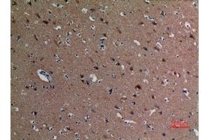 Immunohistochemical analysis of paraffin-embedded human-brain, antibody was diluted at 1:100. (alpha Tubulin Antikörper  (acLys40))