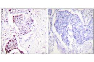 Immunohistochemistry (IHC) image for anti-Ubiquitin (Ubiquitin) (Internal Region) antibody (ABIN1848876) (Ubiquitin Antikörper  (Internal Region))