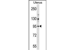 Western blot analysis in human normal Uterus tissue lysates (35ug/lane). (LRRC37B Antikörper  (C-Term))