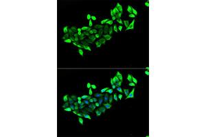 Immunofluorescence analysis of HeLa cells using FLOT1 antibody (ABIN5973661). (Flotillin 1 Antikörper)