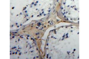 IHC-P analysis of testis tissue, with DAB staining. (Insulin Like Protein 3 (AA 2-129) Antikörper)