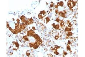 IHC testing of FFPE human pituitary gland with ACTH antibody (clone CLIP/1407). (CLIP Antikörper  (AA 25-39))