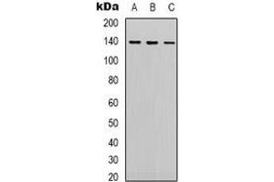 Western blot analysis of HER2 expression in Hela (A), 293 (B), Jurkat (C) whole cell lysates. (ErbB2/Her2 Antikörper)