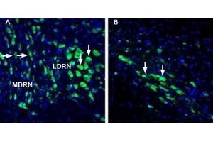 Expression of Lynx1 in rat dorsal raphe nucleus and substantia nigra pars compacta - Immunohistochemical staining of perfusion-fixed frozen rat brain sections with Anti-Lynx1 (extracellular) Antibody (ABIN7043310, ABIN7044635 and ABIN7044636), (1:1000), followed by goat anti-rabbit-AlexaFluor-488. (LYNX1 Antikörper  (Extracellular, N-Term))