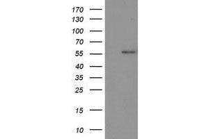 Western Blotting (WB) image for anti-Tumor Protein P53 (TP53) antibody (ABIN1499978) (p53 Antikörper)