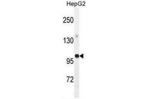 GPAM Antibody (Center) western blot analysis in HepG2 cell line lysates (35µg/lane). (GPAM Antikörper  (Middle Region))