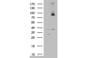 Western Blotting (WB) image for anti-ATP-Binding Cassette, Sub-Family D (Ald), Member 1 (ABCD1) (AA 508-745) antibody (ABIN2715621) (ABCD1 Antikörper  (AA 508-745))