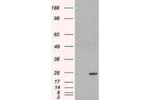 Western Blotting (WB) image for anti-Glutathione S-Transferase pi 1 (GSTP1) (Internal Region) antibody (ABIN2465797) (GSTP1 Antikörper  (Internal Region))