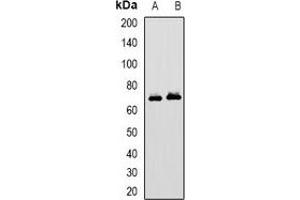 Western blot analysis of MAVS expression in HepG2 (A), MCF7 (B) whole cell lysates. (MAVS Antikörper)