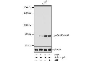 Western blot analysis of extracts of Jurkat cells using Phospho-ZAP70(Y493) Polyclonal Antibody at dilution of 1:5000. (ZAP70 Antikörper  (pTyr493))