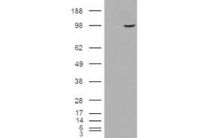 Western Blotting (WB) image for anti-Serine/threonine-Protein Phosphatase 4 Regulatory Subunit 3A (SMEK1) (Internal Region) antibody (ABIN2466283) (SMEK1 Antikörper  (Internal Region))