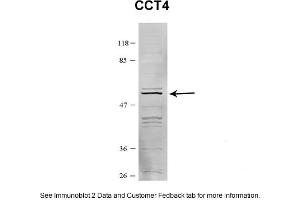 Sample Type: HEK 293 (10ug)Primary Dilution: 1:1000Secondary Antibody: conjugated goat anti-rabbitSecondary Dilution: 1:10,000Image Submitted By: Amy GrayBrigham Young University (CCT4 Antikörper  (C-Term))