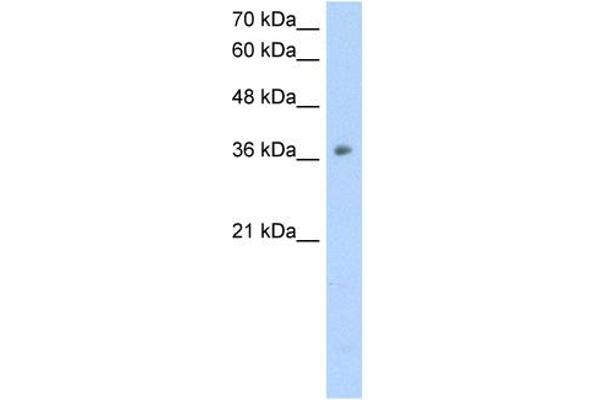 OTC Antikörper  (N-Term)