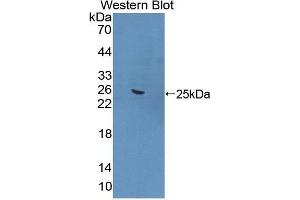Western Blotting (WB) image for anti-Formin Binding Protein 1 (FNBP1) (AA 348-529) antibody (ABIN1868017) (FNBP1 Antikörper  (AA 348-529))