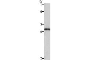 Western Blotting (WB) image for anti-T-Box 5 (TBX5) antibody (ABIN2434989) (T-Box 5 Antikörper)