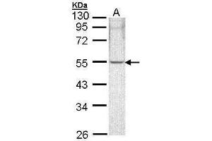 WB Image Sample (30 ug of whole cell lysate) A: A431 , 10% SDS PAGE antibody diluted at 1:1000 (ARHGAP1 Antikörper)