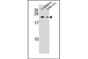 Western blot analysis of RAB12 Antibody (N-term) Cat. (RAB12 Antikörper  (N-Term))