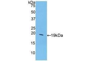 Detection of Recombinant GCSF, Porcine using Polyclonal Antibody to Colony Stimulating Factor 3, Granulocyte (GCSF) (G-CSF Antikörper  (AA 34-193))