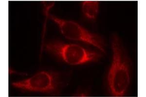 Image no. 2 for anti-Tumor Protein P53 (TP53) (pSer46) antibody (ABIN196786) (p53 Antikörper  (pSer46))