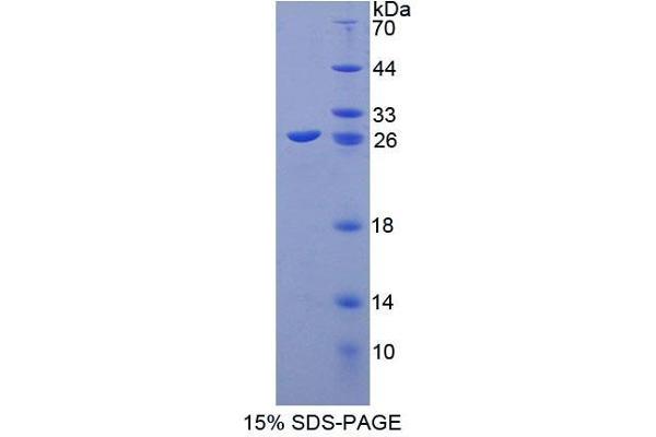 ABCA8 Protein (AA 1303-1514) (T7 tag,His tag)