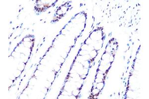 Immunohistochemistry of paraffin-embedded human colon using PRPF8 Rabbit mAb (ABIN7269737) at dilution of 1:100 (40x lens). (PRPF8 Antikörper)