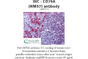 Image no. 1 for anti-B-cell antigen receptor complex-associated protein alpha chain (CD79A) (AA 202-216) antibody (ABIN1723567) (CD79a Antikörper  (AA 202-216))