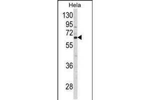 Western blot analysis of CTPS2 Antibody in Hela cell line lysates (35ug/lane) (CTPS2 Antikörper  (N-Term))