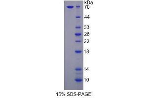 SDS-PAGE analysis of Human LSR Protein. (LSR Protein)