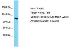 Image no. 1 for anti-TAF3 RNA Polymerase II, TATA Box Binding Protein (TBP)-Associated Factor, 140kDa (TAF3) (AA 288-337) antibody (ABIN6750290) (TAF3 Antikörper  (AA 288-337))