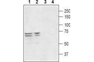 Western blot analysis of rat (lanes 1 and 3) and mouse (lanes 2 and 4) brain lysates: - 1,2. (Peroxisomal Biogenesis Factor 5-Like (PEX5L) (AA 151-165), (Intracellular) Antikörper)