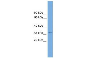 WB Suggested Anti-PRSS21 Antibody Titration: 0. (PRSS21 Antikörper  (N-Term))
