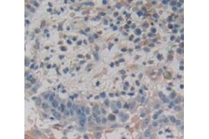 IHC-P analysis of Human Tissue, with DAB staining. (Dermokine Antikörper  (AA 27-238))