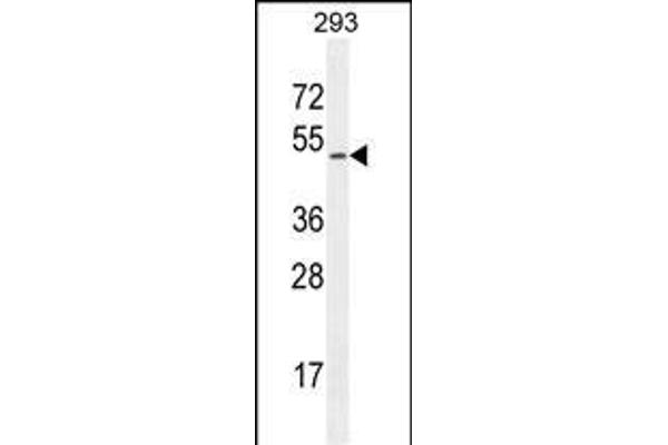 CHRDL1 Antikörper  (N-Term)