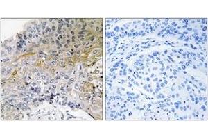 Immunohistochemistry (IHC) image for anti-Breast Cancer Anti-Estrogen Resistance 1 (BCAR1) (AA 376-425) antibody (ABIN2888602) (BCAR1 Antikörper  (AA 376-425))
