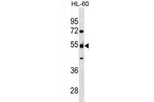 Western Blotting (WB) image for anti-Nucleosome Assembly Protein 1-Like 2 (NAP1L2) antibody (ABIN3000094) (NAP1L2 Antikörper)