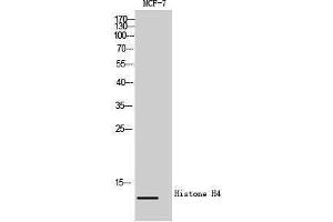 Western Blotting (WB) image for anti-Histone H4 (Lys310) antibody (ABIN6280079) (Histone H4 Antikörper  (Lys310))