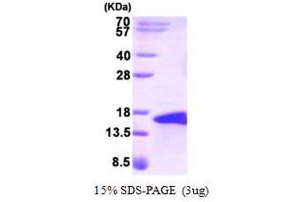 BMP5 Protein (AA 317-454)