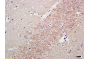 Formalin-fixed and paraffin embedded rat brain labeled with Rabbit Anti KIFC1 Polyclonal Antibody, Unconjugated (ABIN873143) at 1:200 followed by conjugation to the secondary antibody and DAB staining (KIFC1 Antikörper)