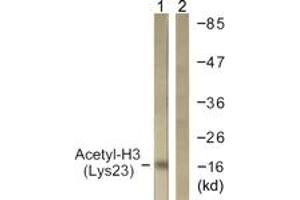 Western Blotting (WB) image for anti-Histone 3 (H3) (H3K23ac) antibody (ABIN2890731) (Histone 3 Antikörper  (H3K23ac))