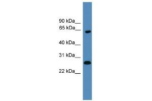 WB Suggested Anti-HMGB1 Antibody Titration: 0. (HMGB1 Antikörper  (Middle Region))