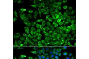 Immunofluorescence analysis of A549 cells using ALDOA Polyclonal Antibody (ALDOA Antikörper)