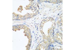 Immunohistochemistry of paraffin-embedded human prostate using CBL antibody. (CBL Antikörper)