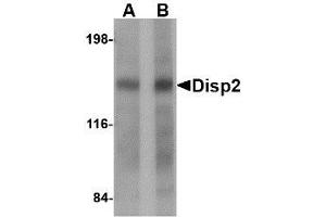 Image no. 1 for anti-Dispatched Homolog 2 (DISP2) (C-Term) antibody (ABIN341692) (DISP2 Antikörper  (C-Term))