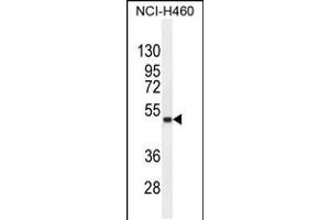 Western blot analysis in NCI-H460 cell line lysates (35ug/lane). (FNDC8 Antikörper  (AA 204-232))