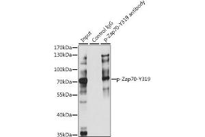 Immunoprecipitation analysis of 200 μg extracts of Jurkat cells, using 3 μg Phospho-Z-Y319 pAb (ABIN3023645, ABIN3023646, ABIN3023647, ABIN1682143 and ABIN1682144). (ZAP70 Antikörper  (pTyr319))